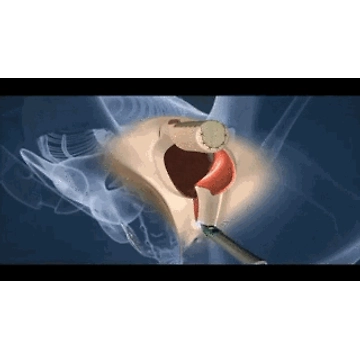 前男友居然去做了变性手术3