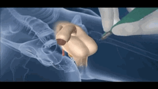 前男友居然去做了变性手术1