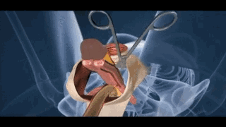 前男友居然去做了变性手术2